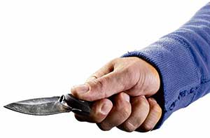 Eşinin Burnunu Kesen Koca Tutuklandı