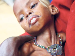 Afrika Komada, Somali Ölüyor