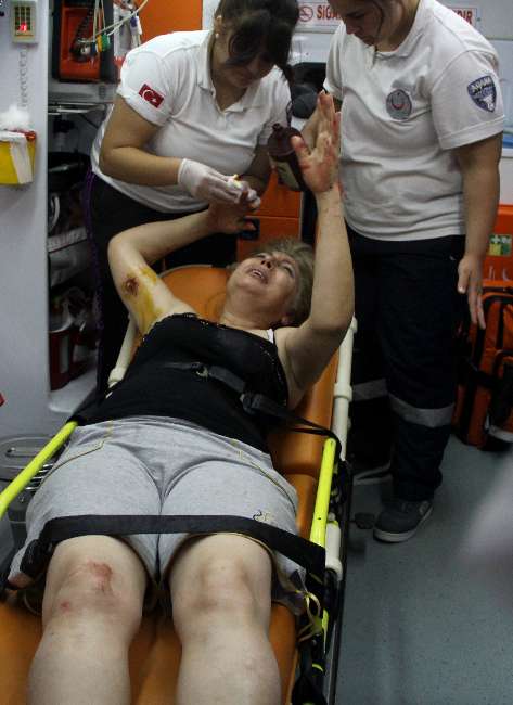 Pitbull Kadını Bu Hale Getirdi