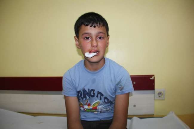 Sibirya Kurdu Cinsi Köpek Dehşet Saçtı