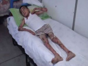 Günden Güne Eriyor