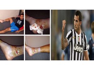 Juventus-g.saray Karşılaşması Öncesi Şok Sakatlık