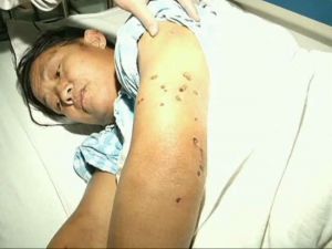 Çin’de Katil Arı Dehşeti: 41 Ölü