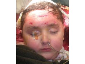 Türk Doktorlarından Yeni Bir Başarı