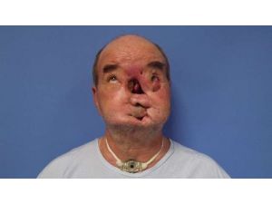 Yeni Yüzünde Sakalları Çıktı