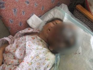 Yüzünde Çıkan Devasa Urla Yaşıyor