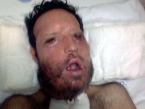 Recep Sert Yeniden Hastanede