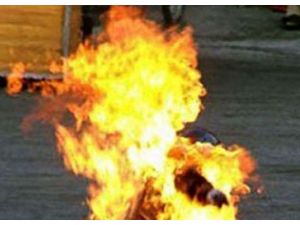 Kızını Yakarak Öldürdü