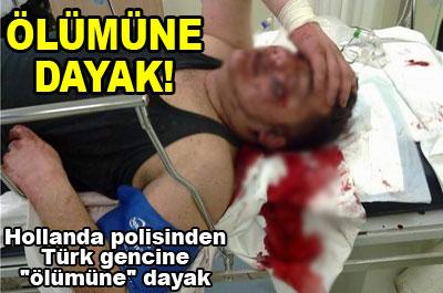 Türk gence Hollandalı polisten dayak 