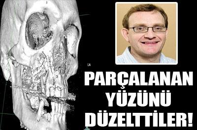 Parçalanan yüzü eski haline getirildi 