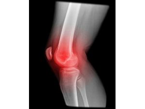 Çocuklarınızdaki Diz Ağrısını Ciddiye Alın