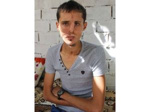 Yedinci Yüz Nakli Tamamlandı