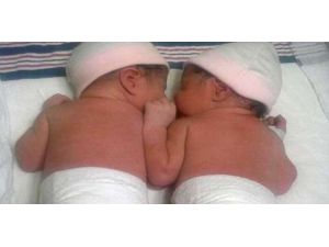 İkizinden 1 Yıl Sonra Doğdu