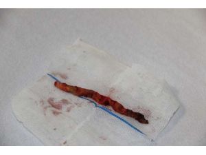 Bunu Gören Doktorlar Bile Hayrete Düştü