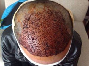 Yabancıların Tercihi Türkiye