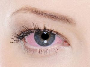 Göz Sağlığınız İçin Soğuk Havaya Dikkat