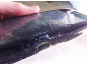 13 Yaşındaki Kızın İphone’u Cebinde Alev Aldı