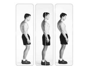 Duruş Bozukluğuna Karşı Uyarı !