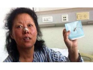 Kafasındaki Mermiyle 48 Yıl Yaşadı