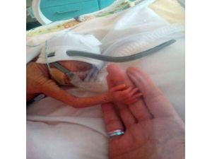 54 Gram Doğan Bebek Bakın Neyle Hayata Tutundu ?