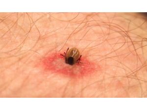 Ordu’nun 7 İlçesinde Kene Mücadelesi Başladı