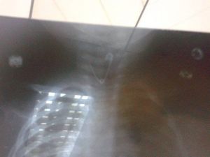 Doktorlar Bile Şaşkına Döndü