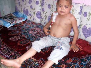 12 Yaşındaki Böbrek Hastası Çocuk Yardım Bekliyor