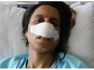(Özel Haber) Kadına Şiddette Son Nokta