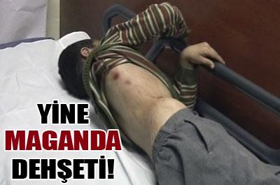 Yine maganda dehşeti 