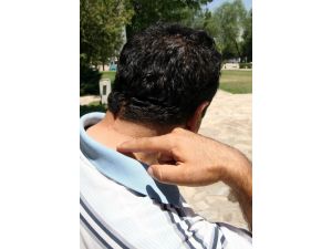 (Özel Haber) Kafasında Unutulan İğneler Hayatını Kararttı