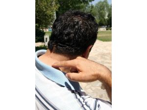 Kafasında Unutulan İğneler Hayatını Kararttı