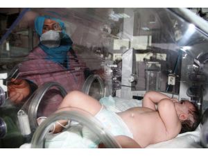 (Özel Haber) Yaşamaz Denilen Gülnur Bebek Ameliyatla Hayata Tutundu