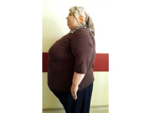 Gazi Yaşargil Hastanesi Obezitede Umut Kapısı Oldu