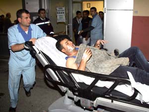 Sobayı Yakmak İsterken Kendisini Yaktı