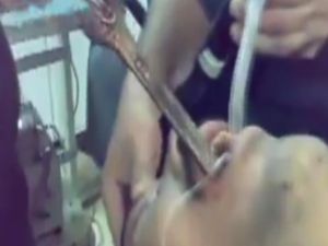 Midesinden Öyle Birşey Çıktı Ki...