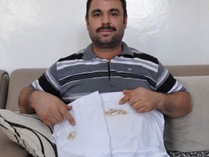 Vücudunun Aniden Yandığını İddia Ediyor