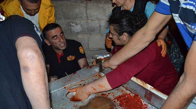 Kıyma Makinesine Elini Kaptırdı