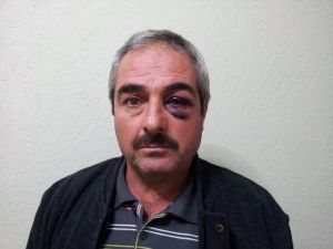 Karaman’da Öğretmene Kerpetenle Saldırı
