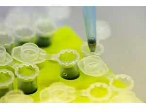 Ebolanın Çaresi Bu İlaç Mı ?