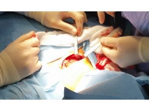 Dünyada Bir İlk Türkiye’de Gerçekleştirildi