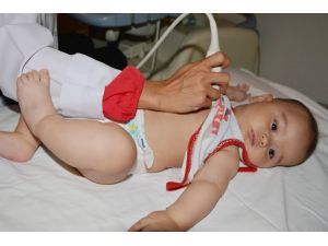 Beş Aylık Bebeğe Anjiyo Yapıldı