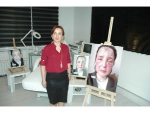 Sahte Doktor Kurbanı Kadının Yüzünde Şaşırtan Değişim