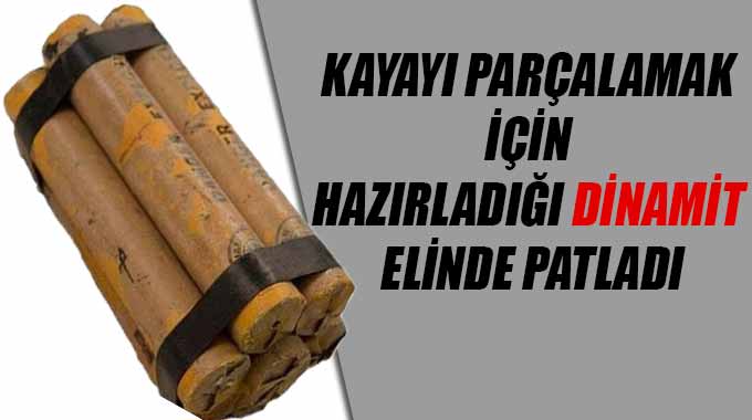 Kayayı Parçalamak İçin Hazırladığı Dinamit Elinde Patladı