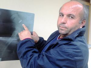 (Özel Haber) 22 Yıldır Pkk Kurşunuyla Yaşıyor