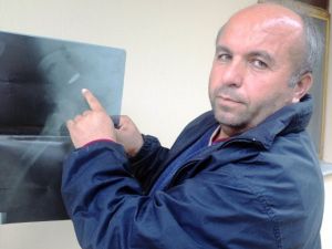 22 Yıldır Pkk Kurşunu İle Yaşıyor