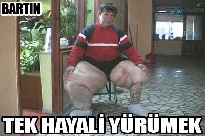 Tek hayali yürümek 