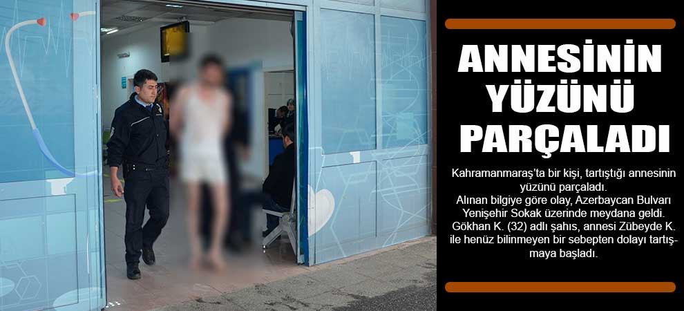 Annesinin Yüzünü Parçaladı