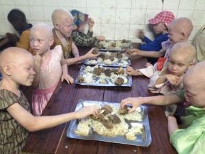 Burhaniye Belediyesi Tanzanya’daki Albino Köyüne Destek Olacak