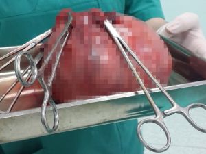 Doktorlar Bile Şaşkına Döndü