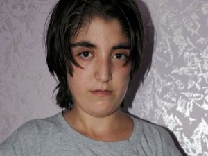 Böbrek Nakline 1 Ay Kala Hayatını Kaybetti